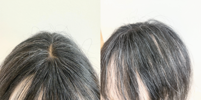 70代女性でくせ毛の白髪ウィッグがつくれます（分け目アップ）｜オーダーメイドウィッグナチュレーヌ