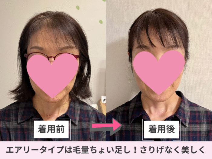 分け目ウィッグ・エアリータイプお客様着用写真｜オーダーメイドウィッグナチュレーヌ