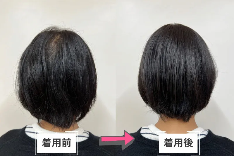 着用前後の比較・後頭部の薄毛カバー