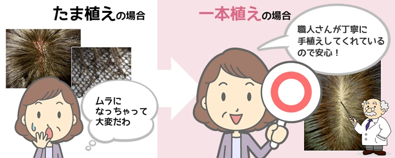 オーダーメイドウィッグナチュレーヌは職人が手植えする一本植え加工です