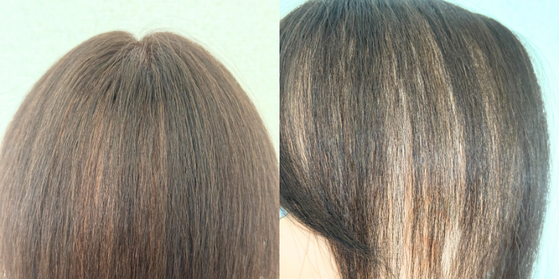 細やかなくせ毛のウィッグ