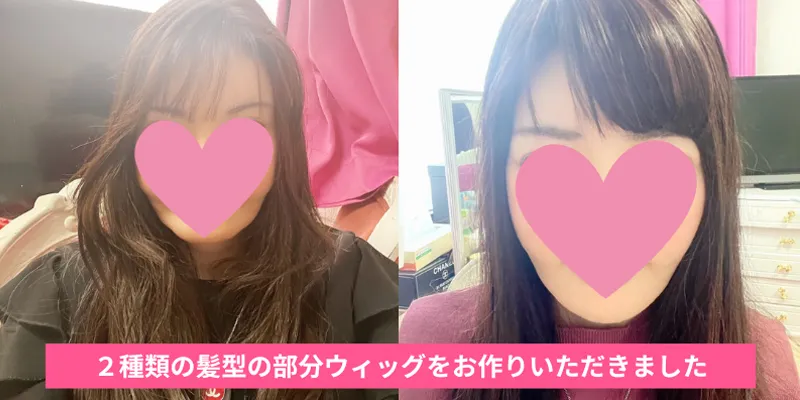 40代のお客様が作られた2種類の部分ウィッグ